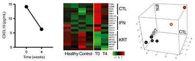 CXCL10 ALADIN Tofacitinib