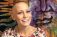 22 Year Old Alopecia Areata Spokeswoman: Abby Andrew